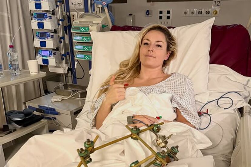 Lindsey Vonn releases emotional statement from hospital bed as extent of  horror leg injury becomes clear | Marca
