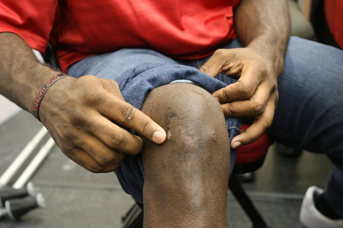 Does a knee replacement can increase the VA disability rating? A simple ...