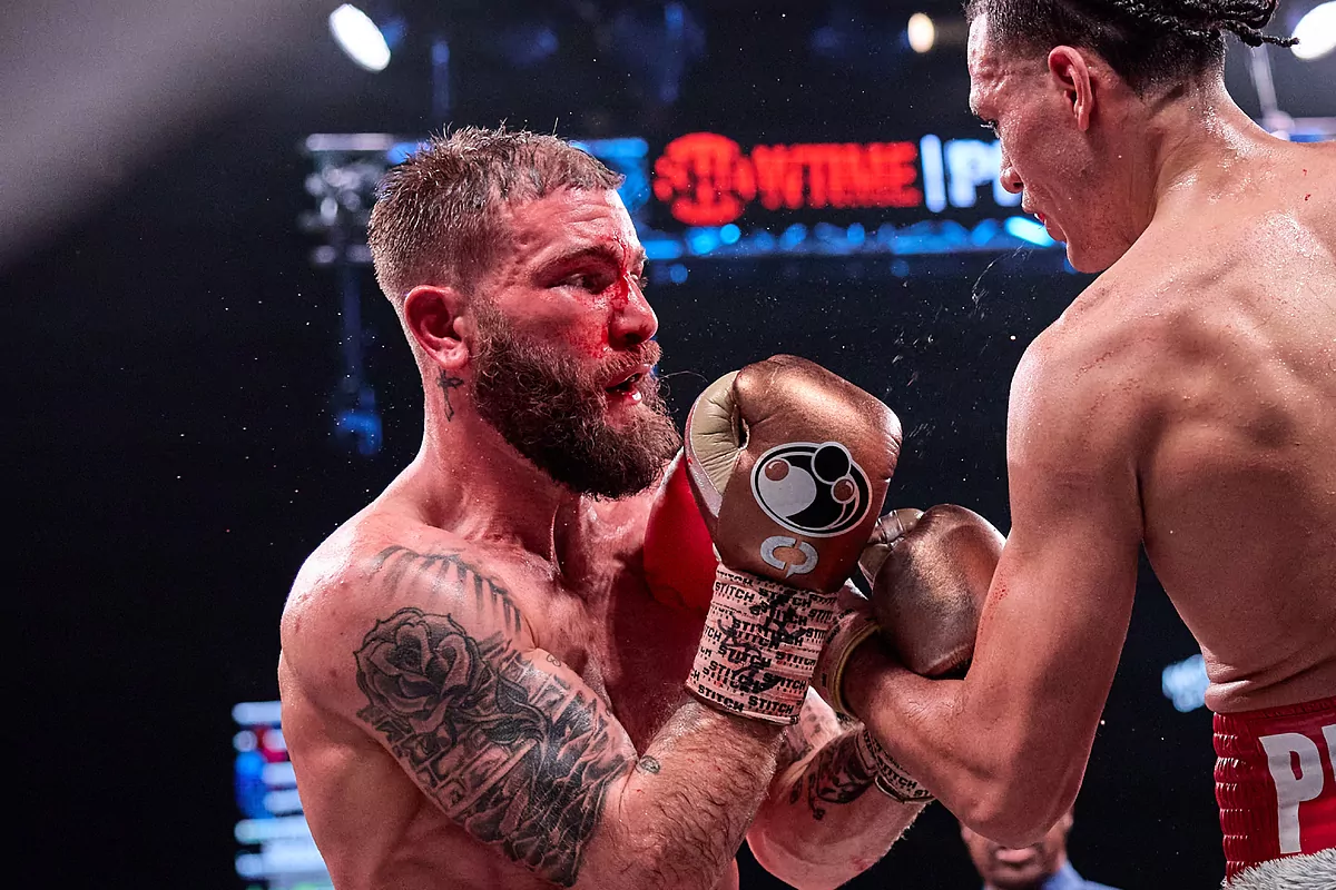 Boxing: Caleb Plant sends message to fans and David Benavidez from the  hospital : "I'll be back. He was the better man" | Marca