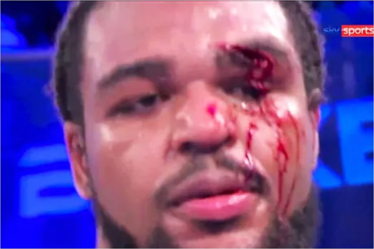 Boxing: Jeamie Tshikeva's horrific eye injury that disfigured his face ...