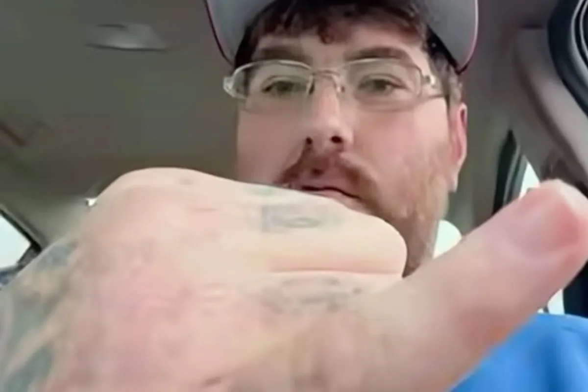 Who is Michael Phillips? The North Carolina man who claims to have the smallest penis in the world