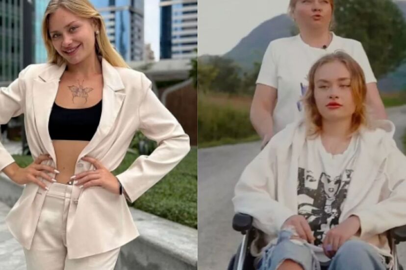 Model found on side of road in Dubai with broken spine and legs makes bold career move